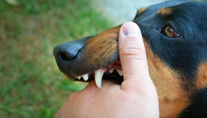 Dog showing teeth while biting a person’s hand, illustrating Texas Dog Bite Laws and owner liability.