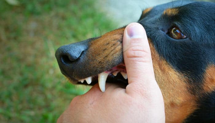 Dog showing teeth while biting a person’s hand, illustrating Texas Dog Bite Laws and owner liability.