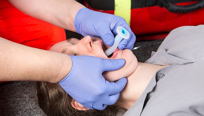 Airway Management Errors - Myleagalopinion 1 - My Legal Opinion A paramedic performing airway management on a patient in an emergency, showcasing the critical role of proper airway handling in preventing anesthesia errors.