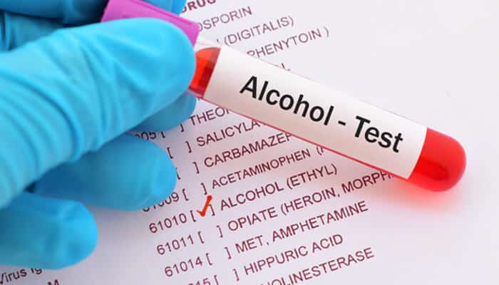 Blood Alcohol Concentration BAC Test Results - Myleagalopinion - My Legal Opinion Alcohol test being conducted, crucial in determining impairment in drunk driving car accident cases.