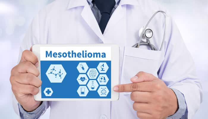 Doctor holding a tablet displaying Mesothelioma diagnosis and medical icons, highlighting the importance of understanding Mesothelioma legal rights.