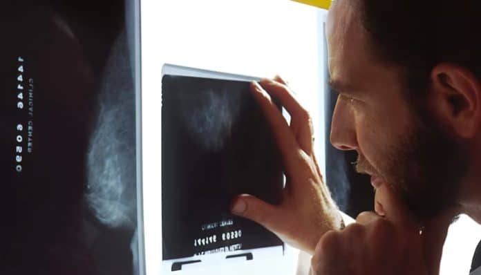 Doctor reviewing medical scan results related to cancer diagnosis, highlighting reasons to hire a lawyer after a cancer diagnosis.