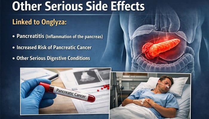 Other Serious Side Effects - My Legal Opinion - My Legal Opinion Onglyza Lawsuit image illustrating serious side effects of saxagliptin including pancreatitis, increased pancreatic cancer risk, and digestive complications with medical visuals of pancreas inflammation, lab test sample, and hospitalized patient